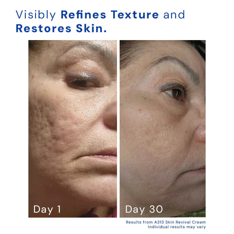 A313 Vitamin A & Retinol Cream